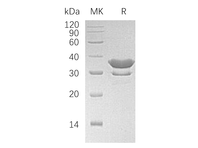 Recombinant Human SULT2A1 (N-6His)