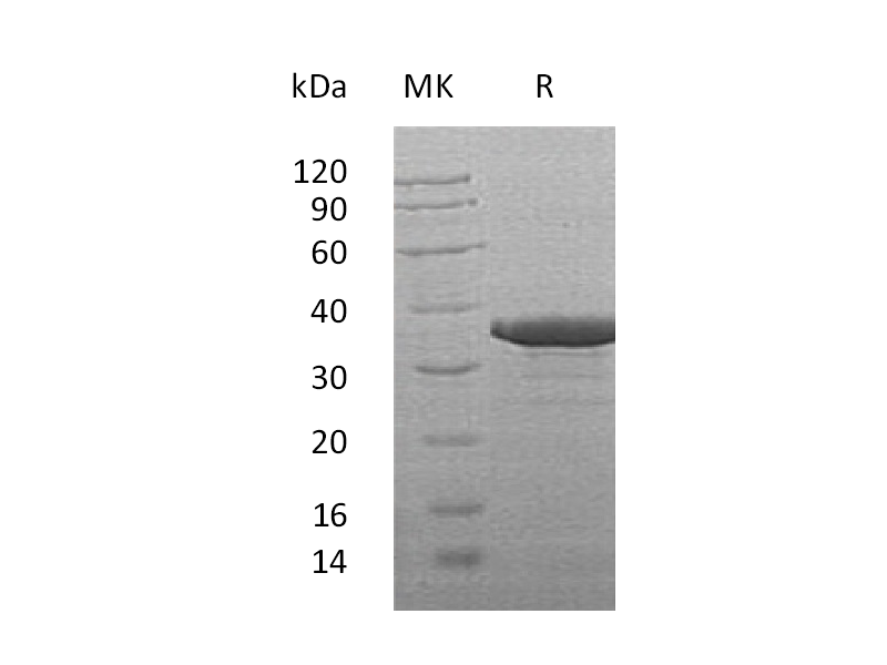 Recombinant Human SULT2B1 (C-6His)