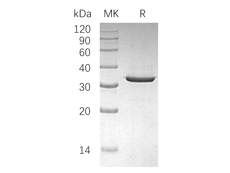 Recombinant Human SULT4A1