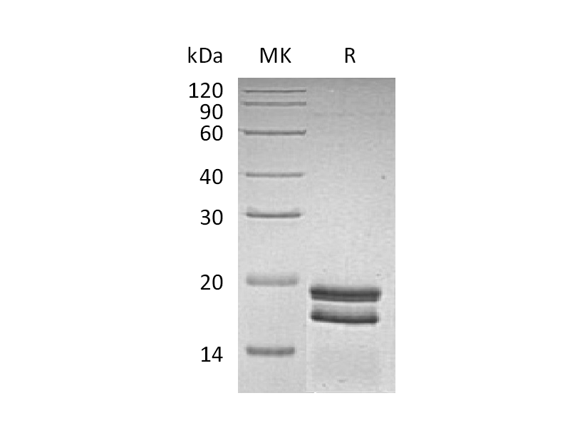 Recombinant Human SUMO1 (N-6His)