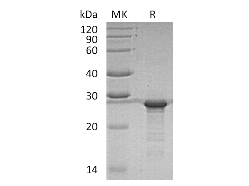 Recombinant Human YKT6 (N-6His)