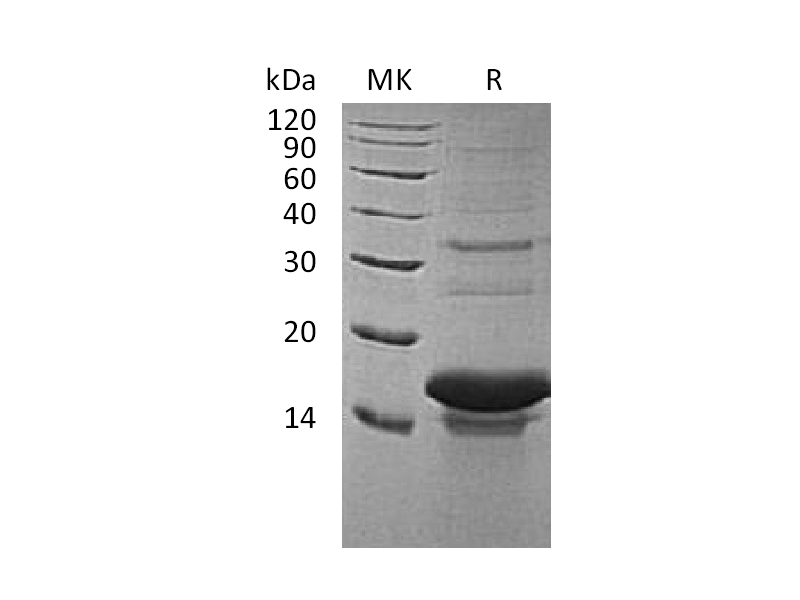 Recombinant Human TAC3 (N-6His)