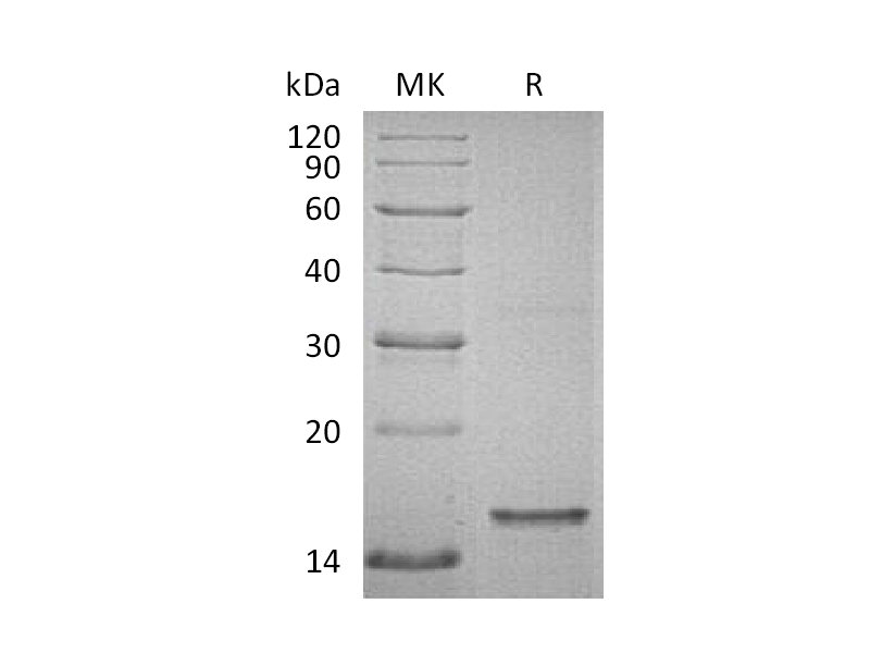 Recombinant Human Tau-D (C-6His)