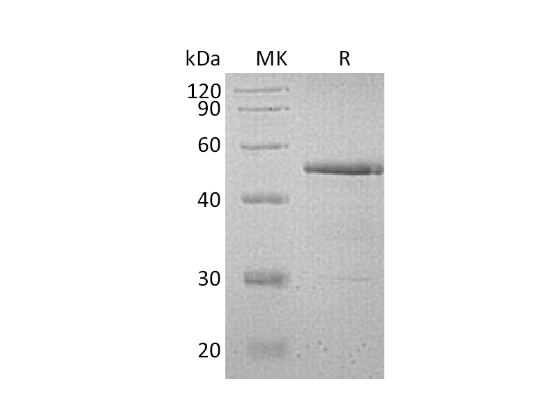 Recombinant Human Testin (C-6His)