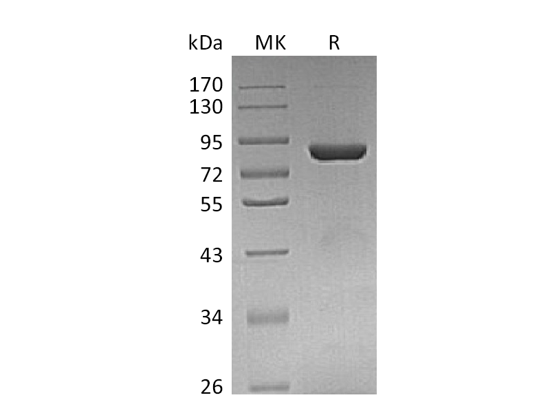 Recombinant Human THOP1 (C-6His)