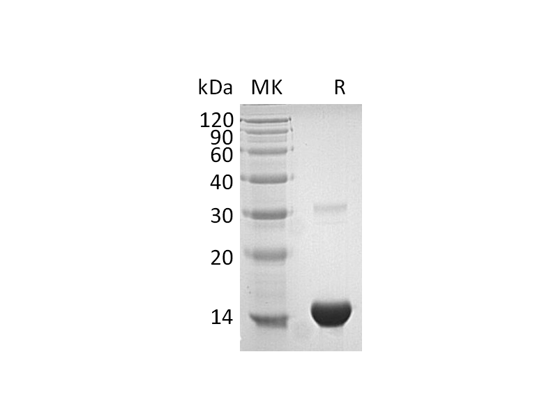 Recombinant Human TXN (N-6His)