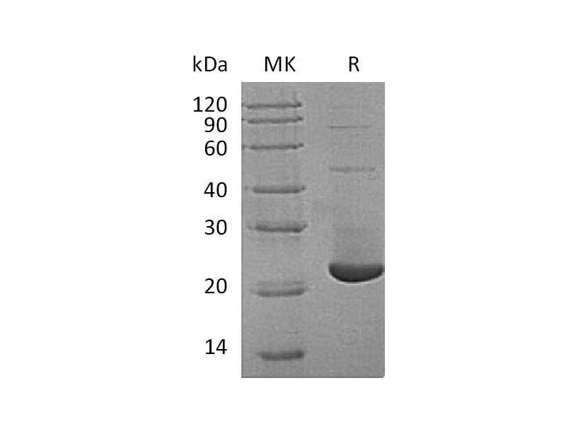 Recombinant Human TMX2 (N-6His)