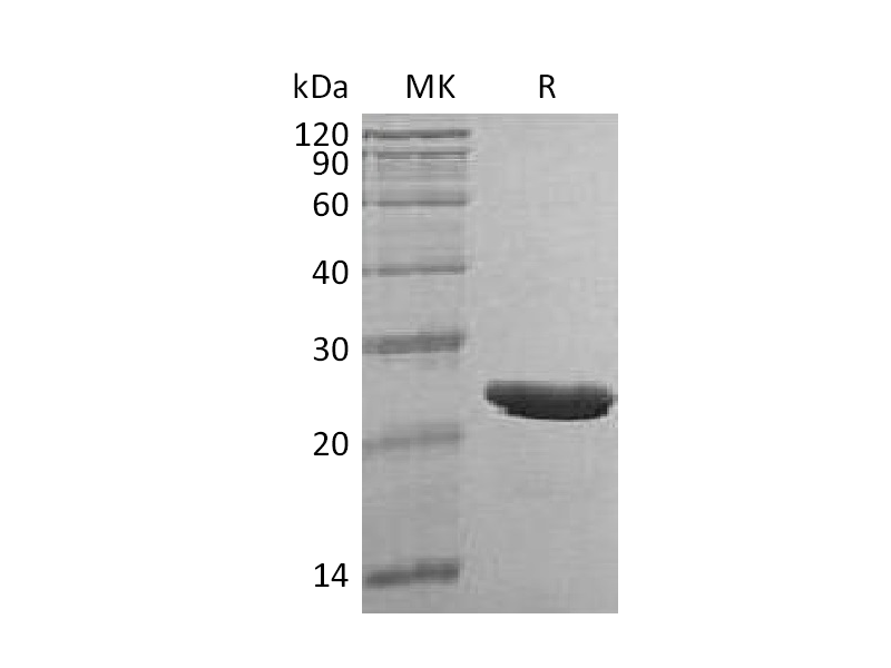 Recombinant Human TMPO (C-6His)
