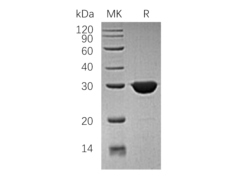 Recombinant Human TIM (N-6His)