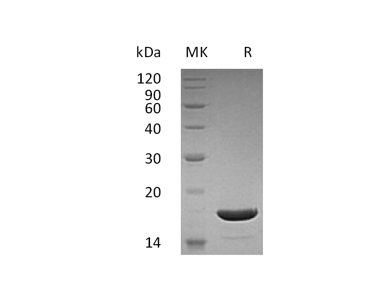 Recombinant Human TRAIL