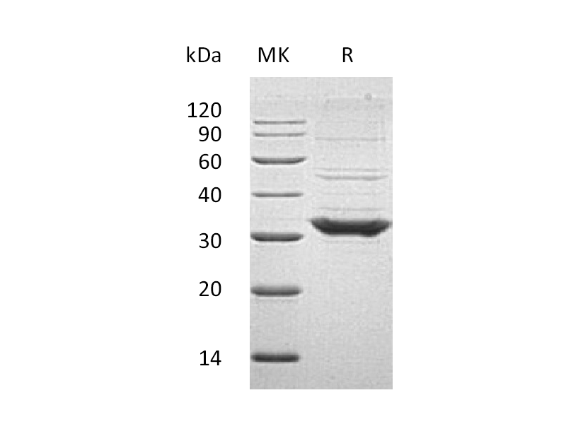 Recombinant Human TOLLIP (C-6His)