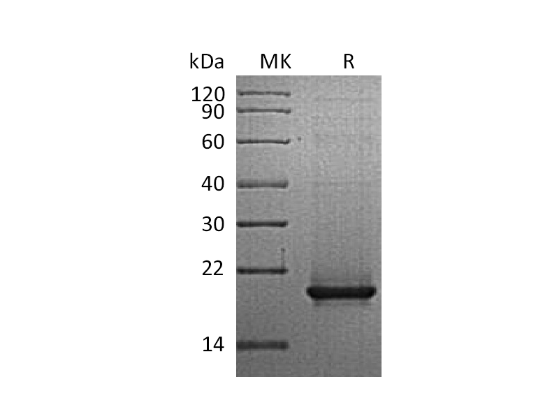 Recombinant Human RANK L