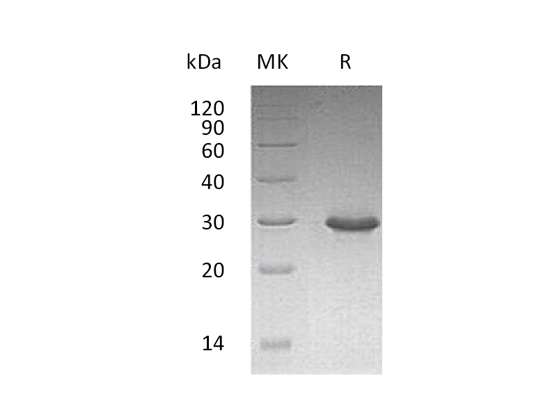 Recombinant Human TRIM (C-6His)