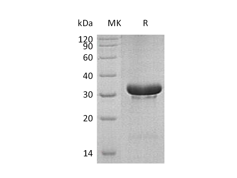Recombinant Human TRIM5 (N-6His)