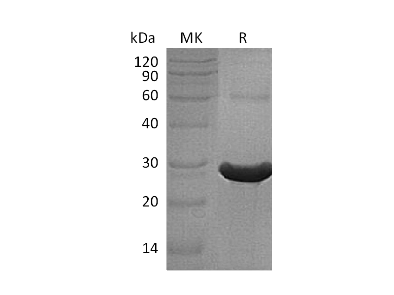 Recombinant Human TXLNA (N, C-6His)