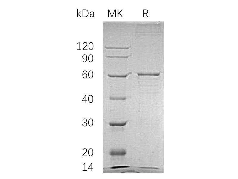 Recombinant Human BLK (C-6His)