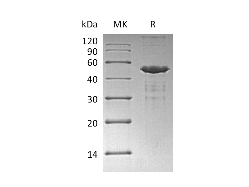 Recombinant Human UBE2A (N-GST, 6His)