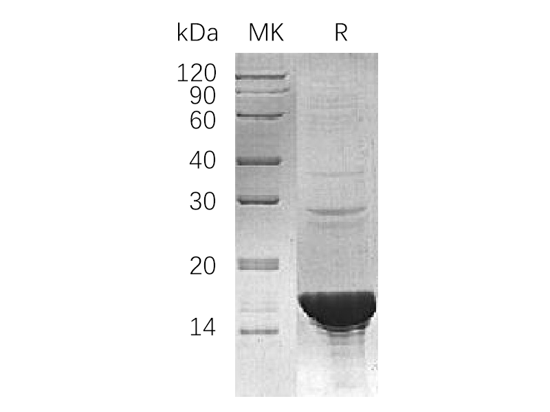 Recombinant Human UBE2B