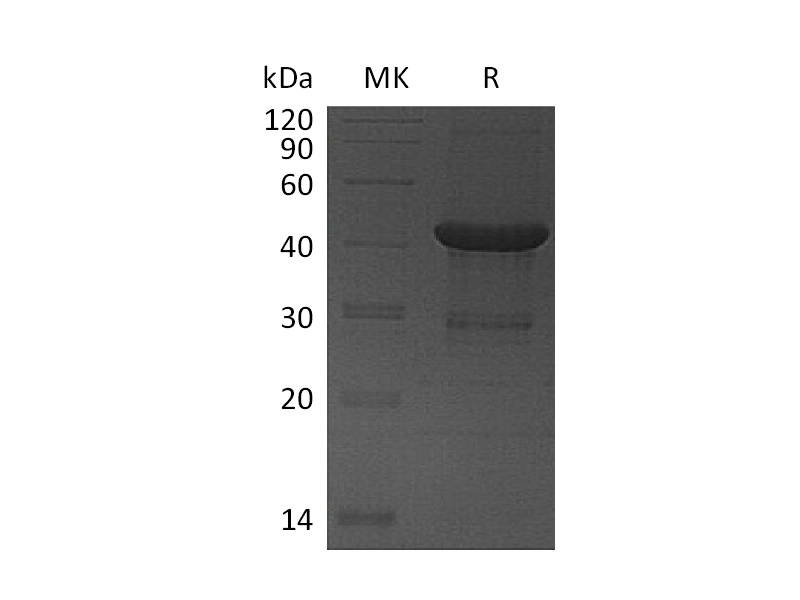 Recombinant Human UBE2D4 (N-GST)