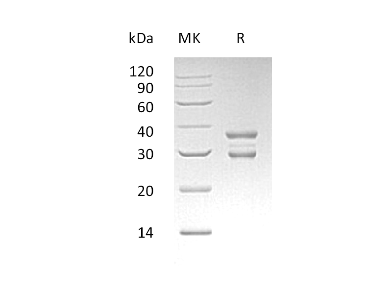 Recombinant Human UBE2J2 (N-GST)