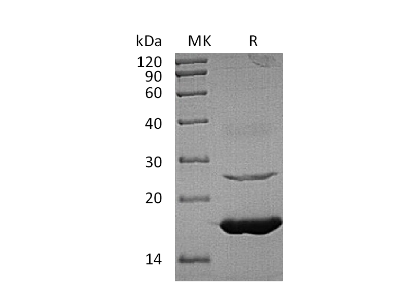 Recombinant Human UBE2L6 (C-6His)