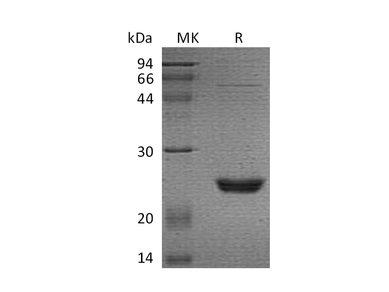 Recombinant Human UBE2M