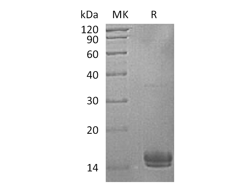 Recombinant Human UBE2V1 (C-6His)