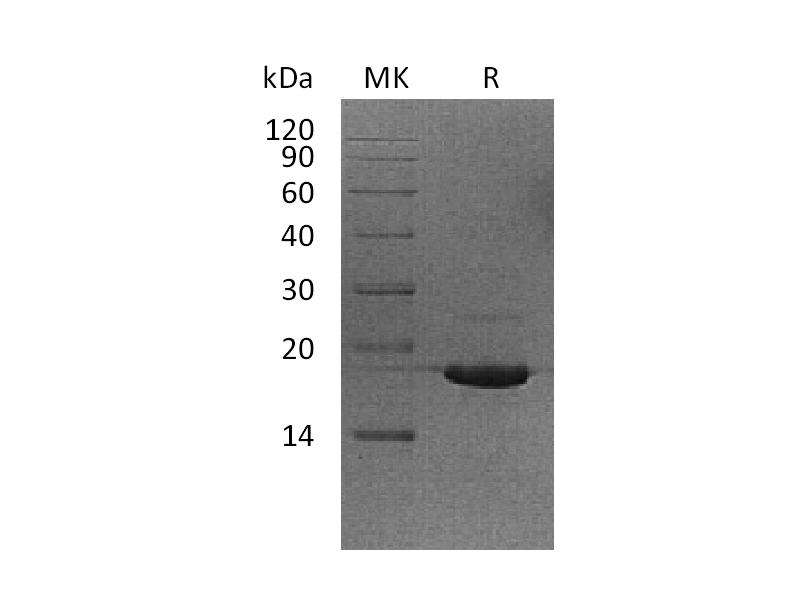 Recombinant Human UBE2V2 (N-6His)