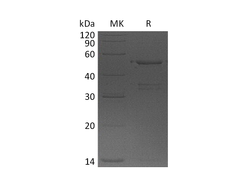 Recombinant Human USP14 (N-6His)