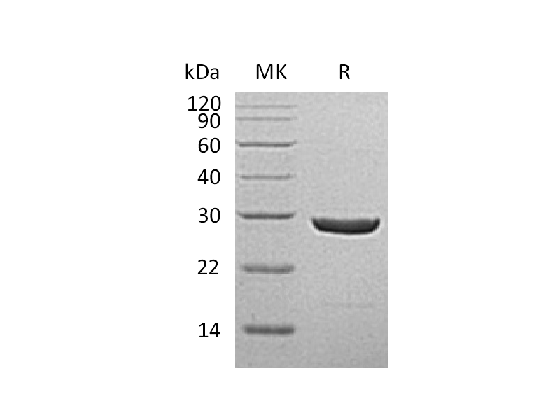 Recombinant Human UCH-L1 (C-6His)