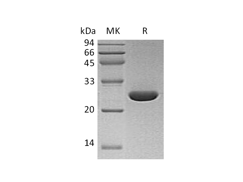 Recombinant Human UCH-L3 (C-6His)
