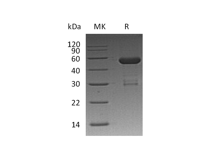 Recombinant Human OTUB2 (N-GST)