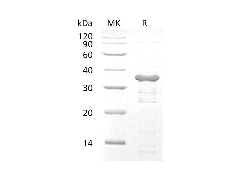 Recombinant Human UBE2R2 (N-6His)
