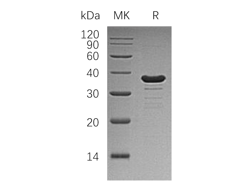 Recombinant Human GALE (N-6His)
