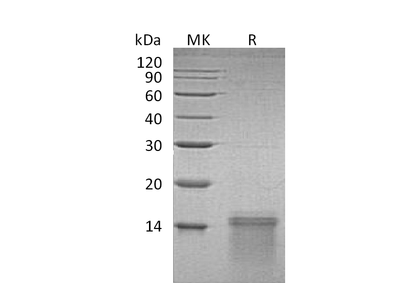 Recombinant Human UCMA