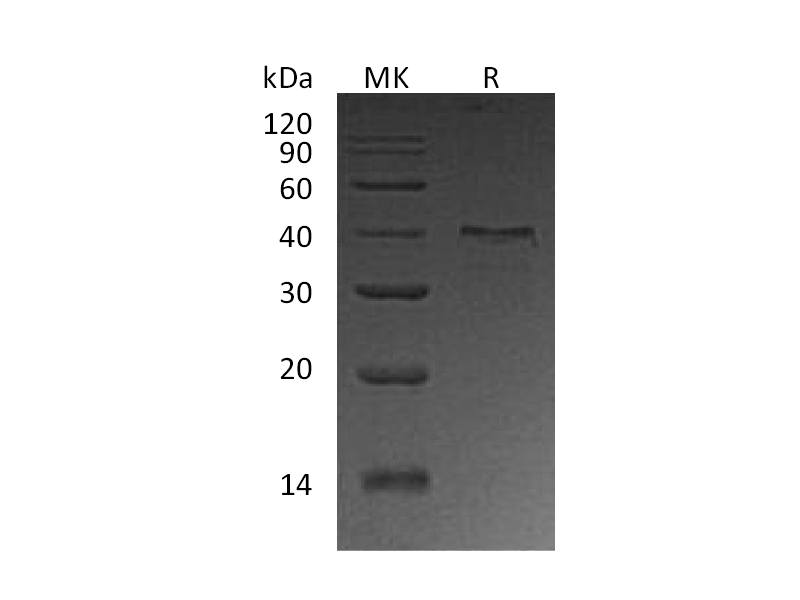 Recombinant Human UPRT (N-6His)
