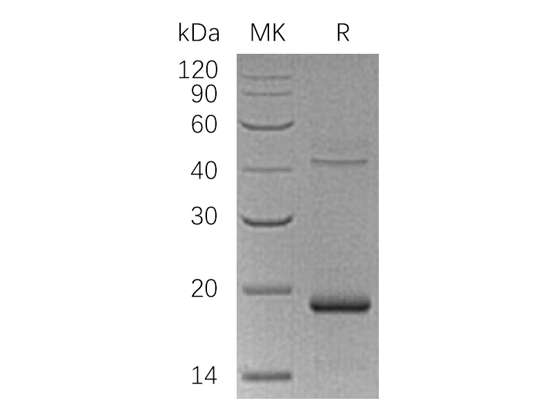 Recombinant Human UPP1 (N-6His)