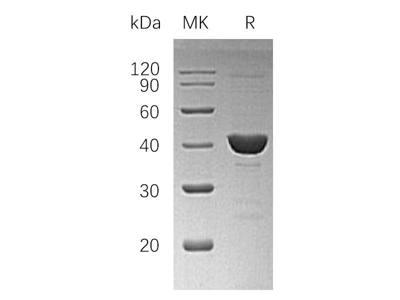 Recombinant Human UROD (N-6His)