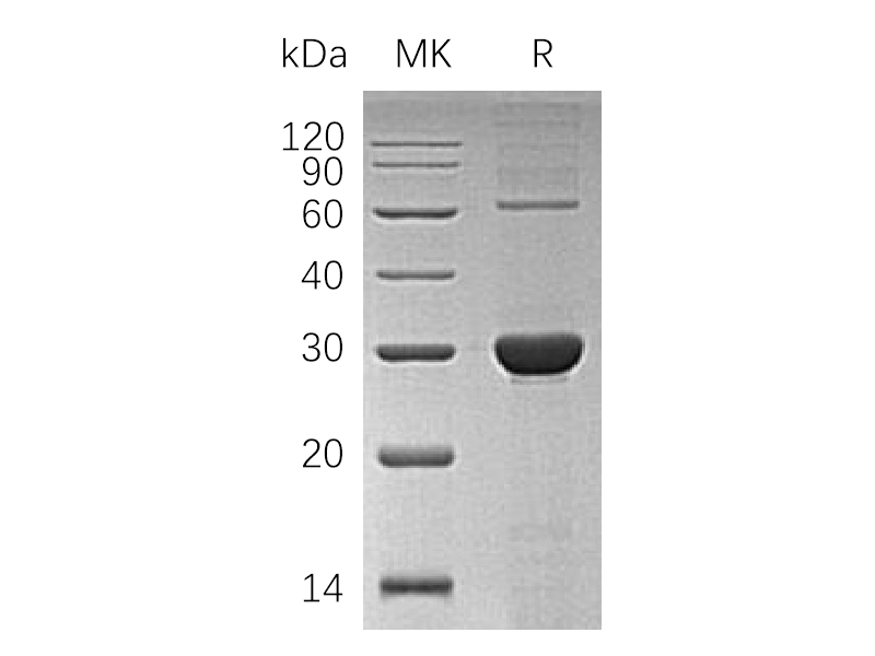 Recombinant Human UROIIIS (C-6His)