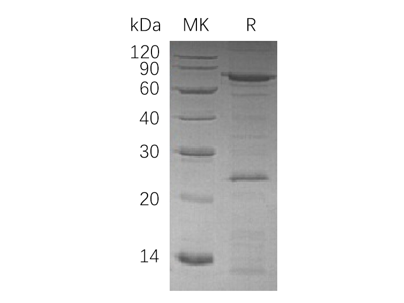 Recombinant Human VCP (C-6His)