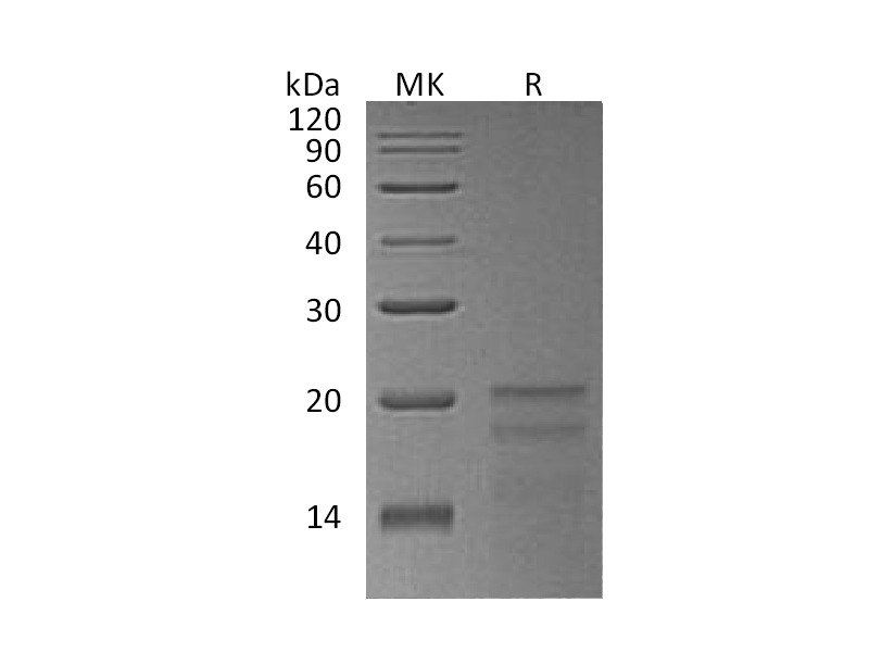 Recombinant Human ZNHIT1 (N-6His)