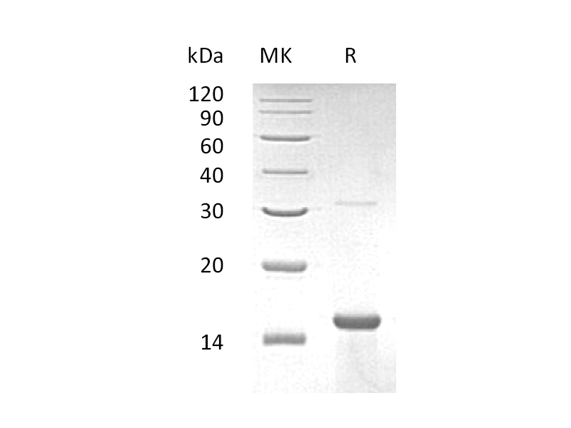 Recombinant Human ZNF100 (N-6His)