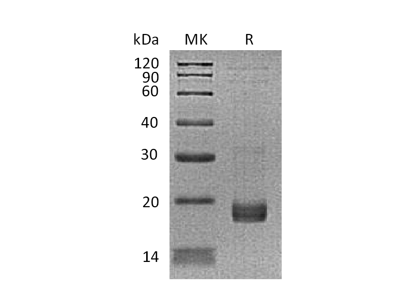 Recombinant Human TNNC1 (N-6His)