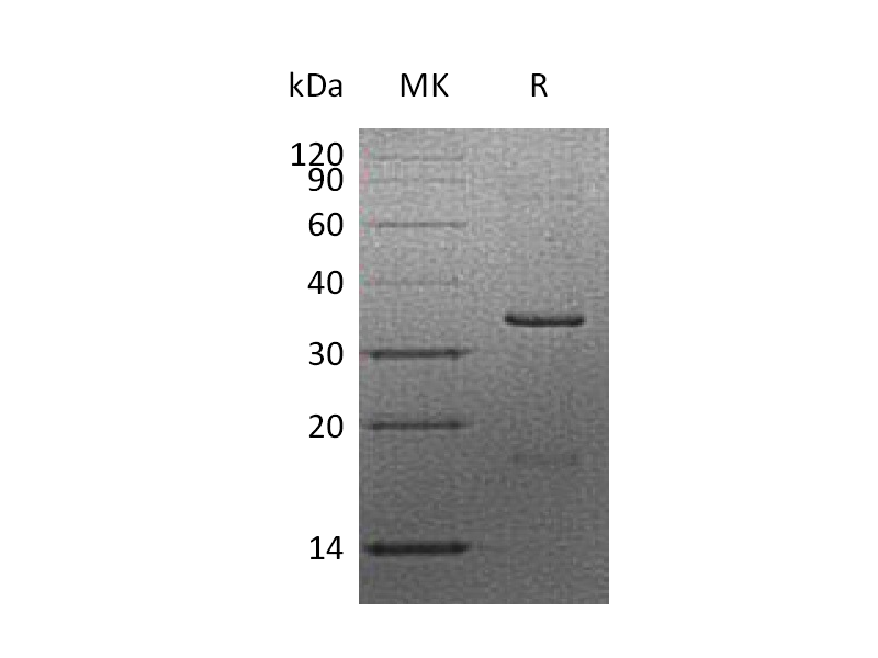 Recombinant Human CCND2 (N-6His)
