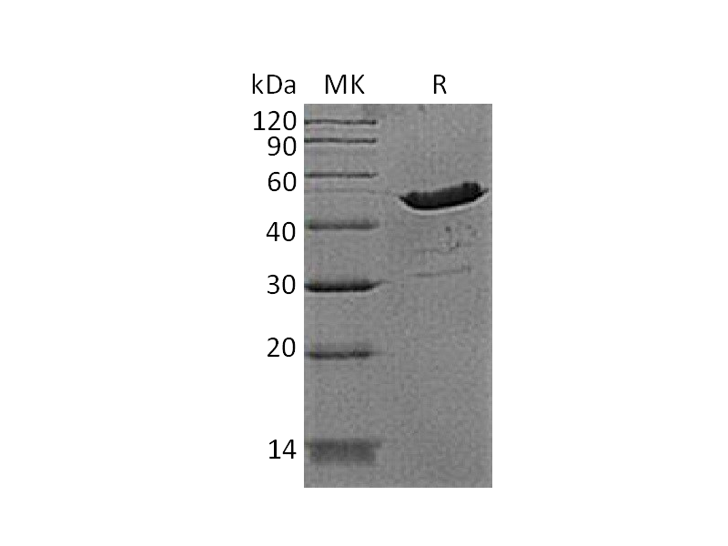 Recombinant Human CKB (N-6His)