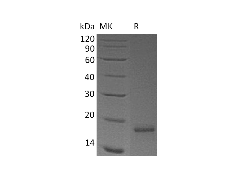 Recombinant Human Claudin-18.2 (N-8His)