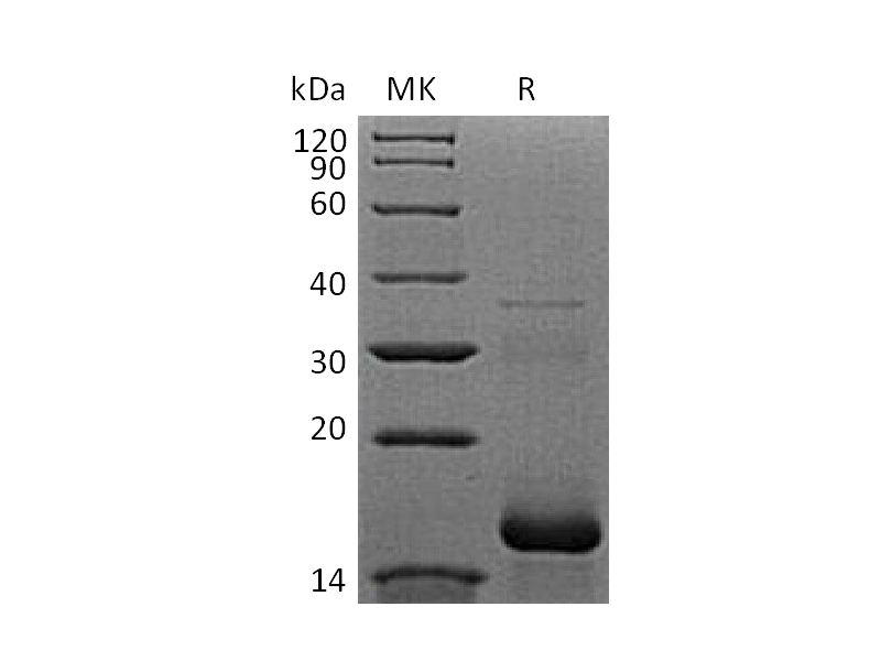 Recombinant Human APOB (N-6His)