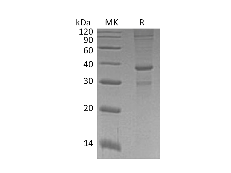 Recombinant Human ASXL1 (N-GST)