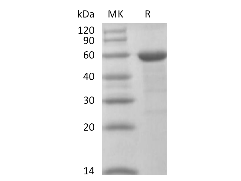 Recombinant Human BRD4 (N-10His-Flag)