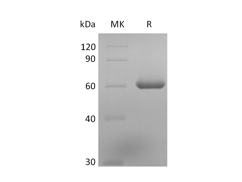 Recombinant Human TDT (N-6His)